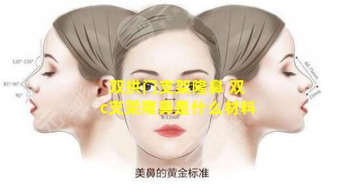 双拱门支架隆鼻 双c支架隆鼻是什么材料
